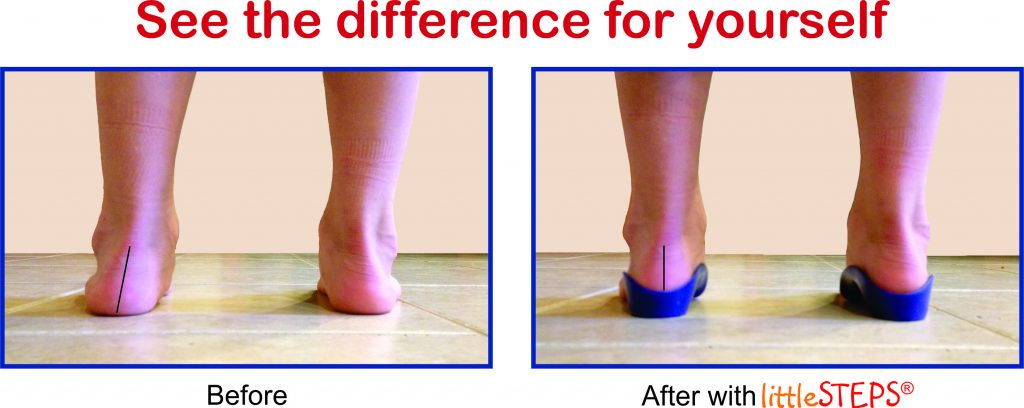 see-the-difference-little-steps