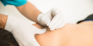 Man receiving dry needling therapy in clinic